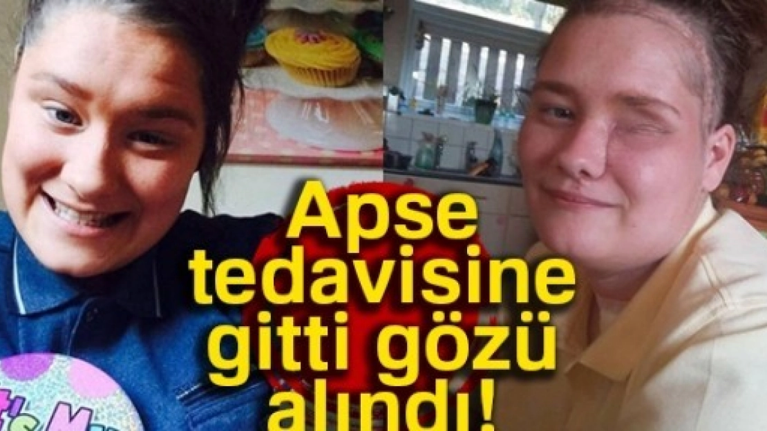 Apse Tedavisine Gitti,Gözünü Aldılar