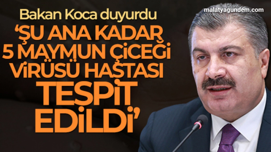 Bakan Koca: 'Şu ana kadar ülkemizde 5 maymun çiçeği virüsü hastası tespit edildi'