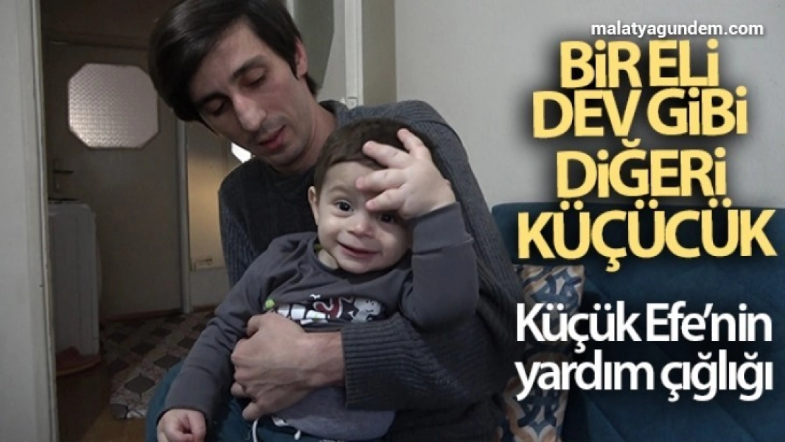 Bir eli dev gibi, diğeri küçücük