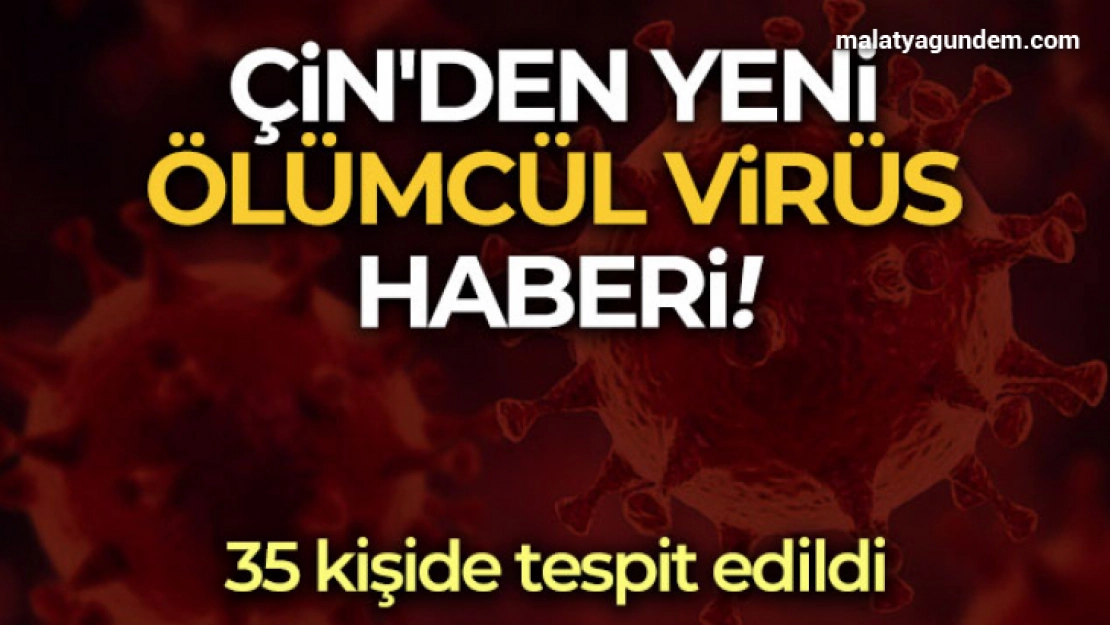 Çin'den yeni ölümcül virüs haberi: 35 kişide tespit edildi