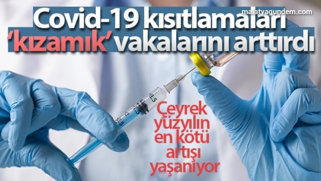 Covid-19 kısıtlamaları 'kızamık' vakalarını arttırdı