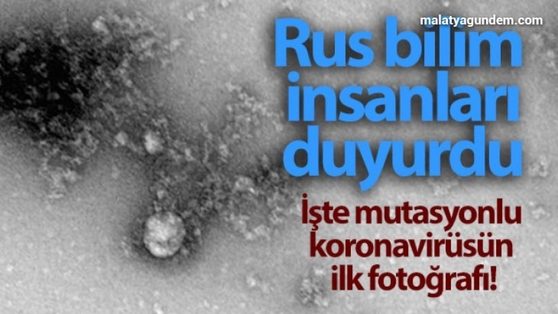Rusya'da, korona virüs mutasyonunun fotoğrafı çekildi