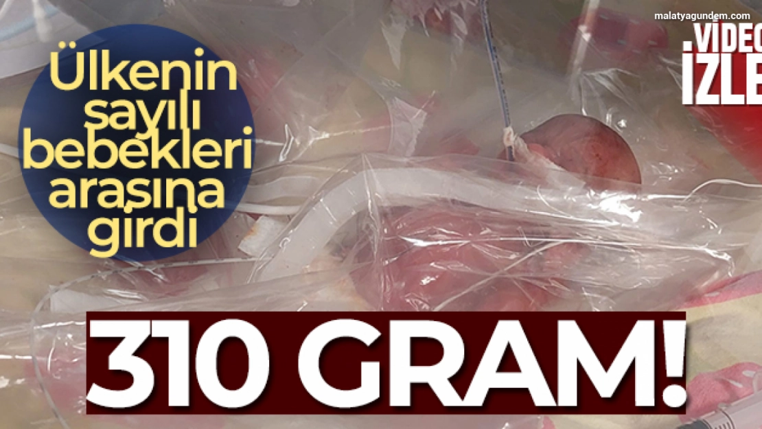 Tekirdağ'da 310 gramlık bebek doğdu