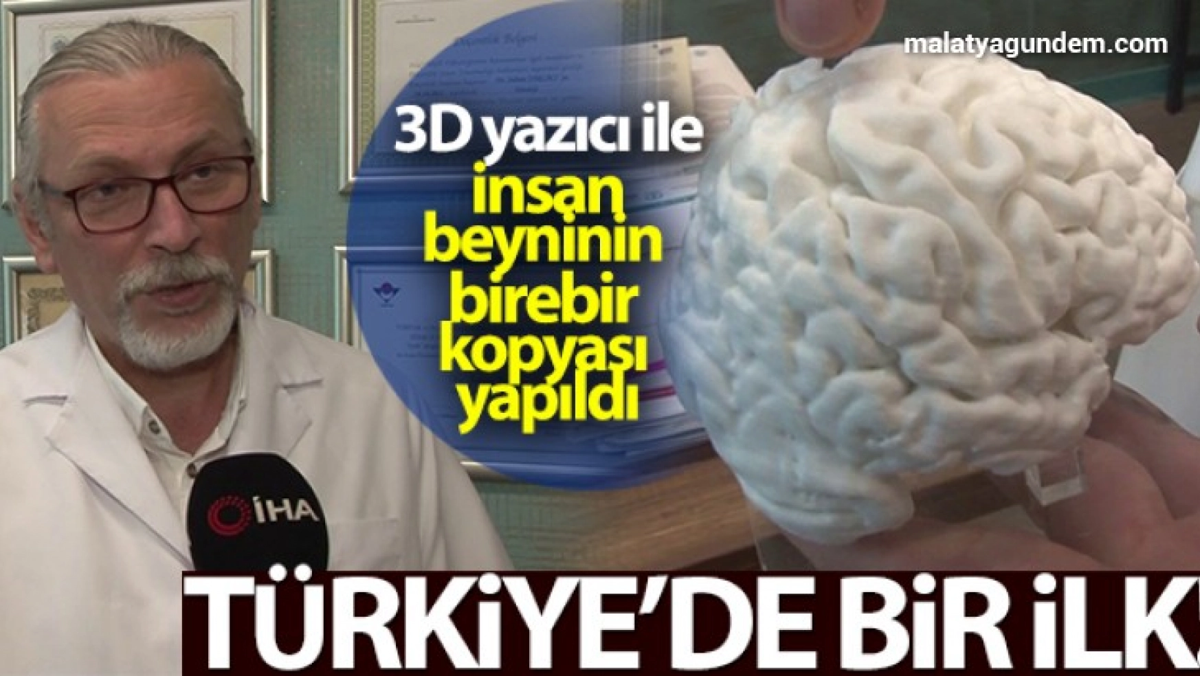 3D yazıcı ile insan beyninin birebir kopyası yapıldı
