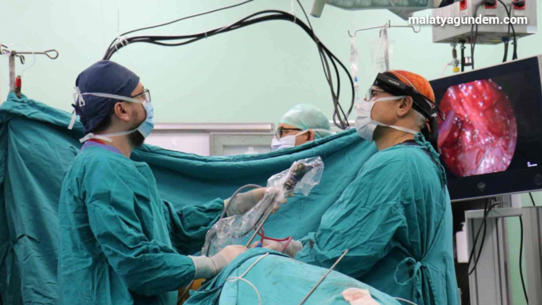 TÖTM'de çevrimiçi Torasik Cerrahi Akciğer ameliyatı
