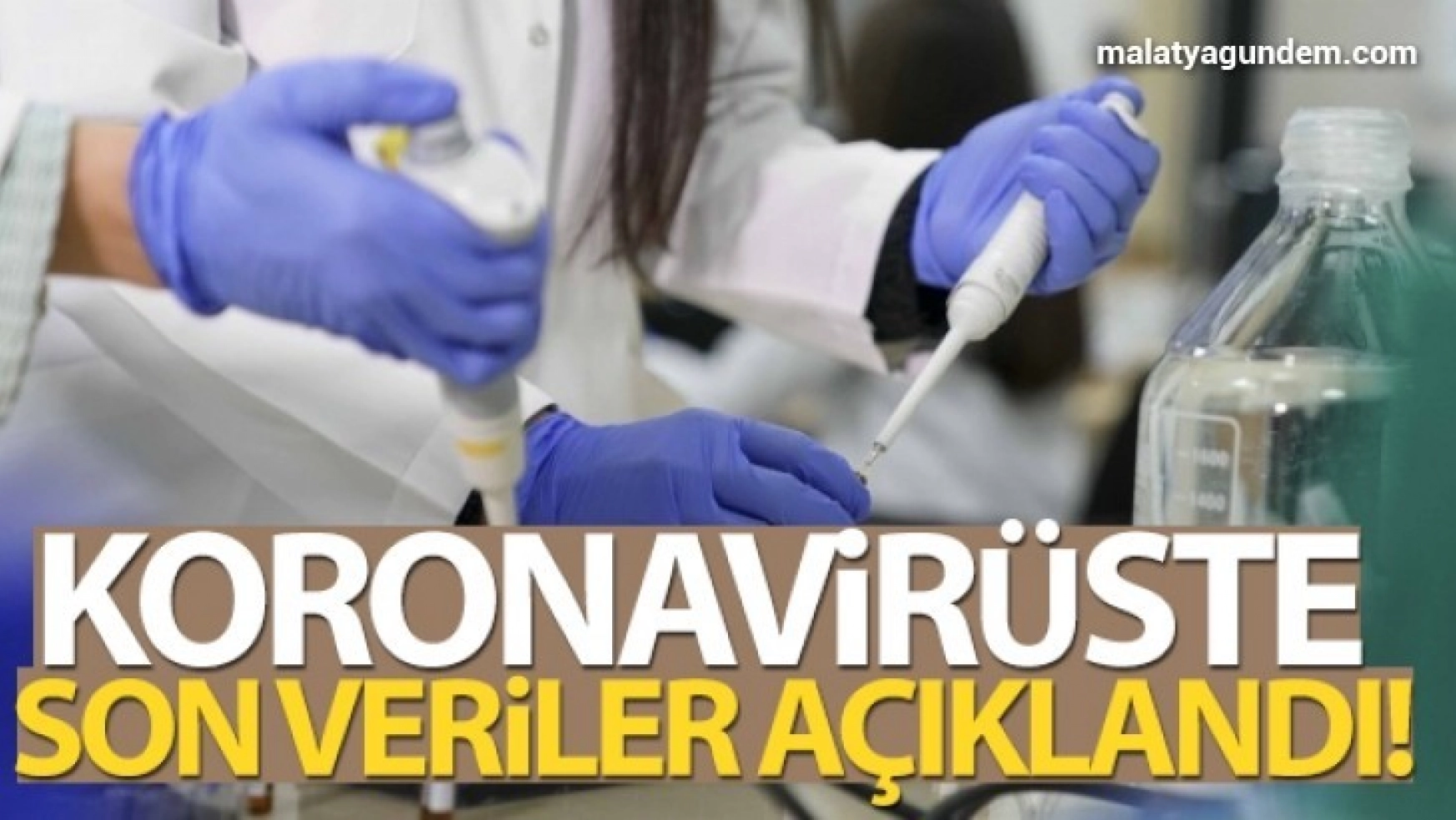 Türkiye'de son 24 saatte 11.302 koronavirüs vakası tespit edildi