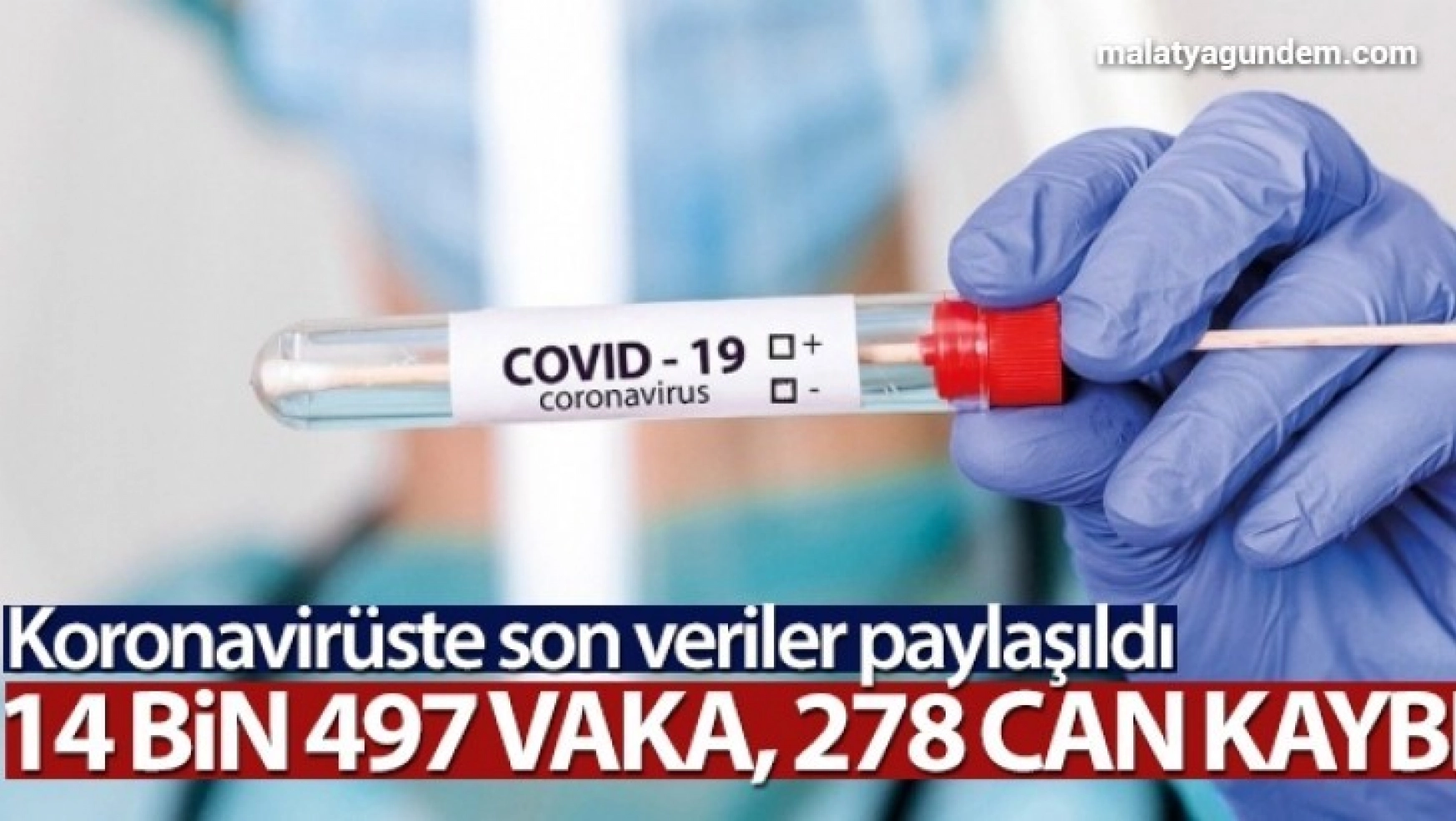 Türkiye'de son 24 saatte 14.497 koronavirüs vakası tespit edildi