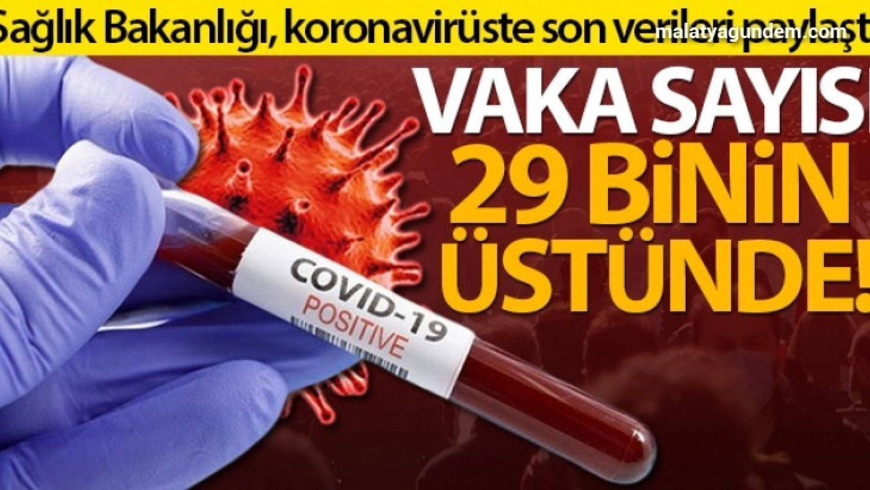 Türkiye'de son 24 saatte 29.081 koronavirüs vakası tespit edildi
