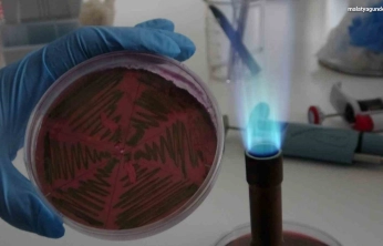 Çiğ süt, gıdayla bulaşan idrar yolu enfeksiyonlarına kapı açıyor