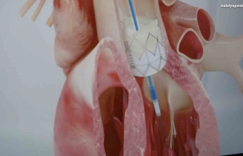 Prof. Dr. Pekdemir: 'Gençlerde ani ölümlerin yüzde 90'ı genetik nedenlerden kaynaklanıyor'