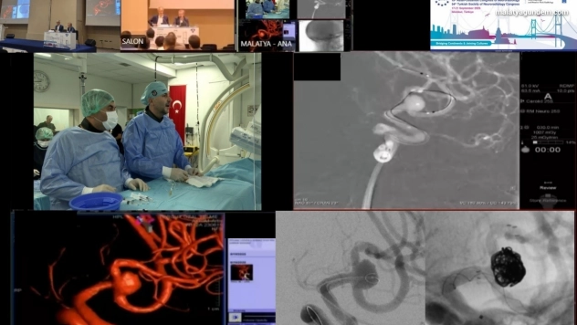 Canlı yayında zorlu beyin ameliyatı