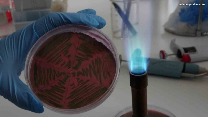 Çiğ süt, gıdayla bulaşan idrar yolu enfeksiyonlarına kapı açıyor